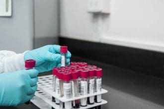 How to find out blood type in the UK
